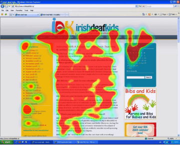 Eyetracking