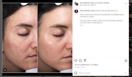 healthcare skin clinic before and after social post example